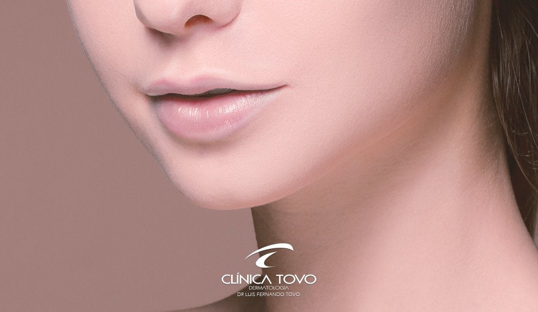 Tratamento do terço inferior da face (queixo duplo, flacidez de pescoço e de face) por radiofrequência invasiva