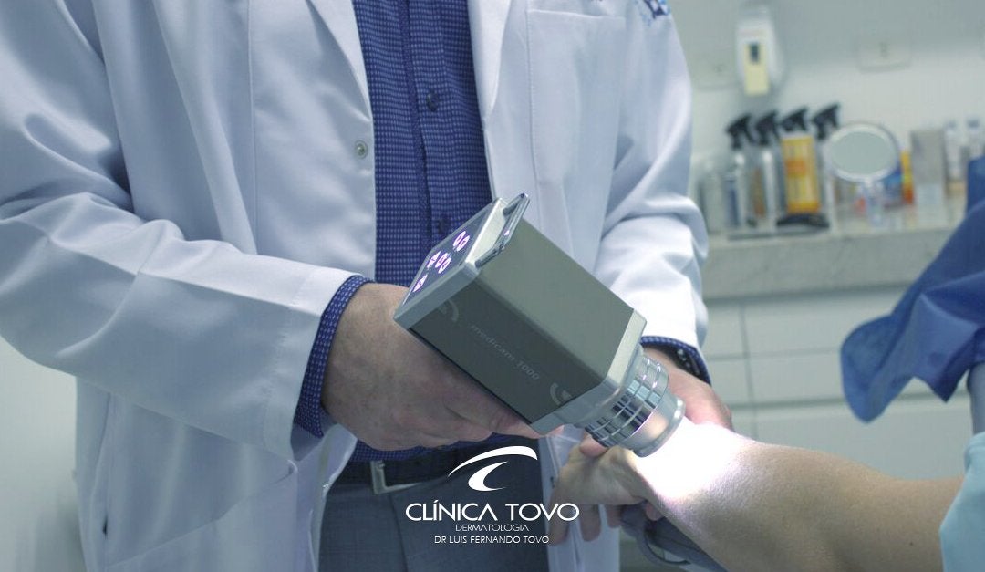 Dermatoscopia Digital e Mapeamento Corporal