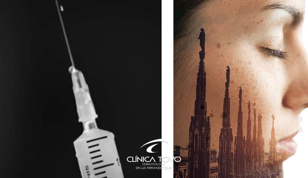 Preenchedores Cutâneos: Discussões e Apresentação de Complicações World Congress of Dermatology Milan Junho 2019 Clinica Tovo Dermatologia Dr Tovo LUIS FERNANDO TOVO.