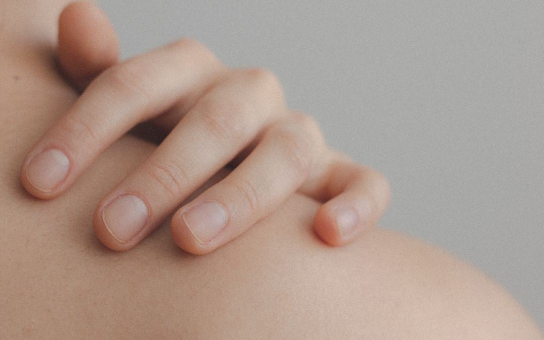 Melanoma de Unhas: Quais são os Sinais e Como Diagnosticar