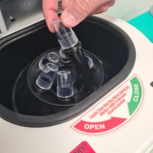 tovo dermato prp calvície CLINICA TOVO PLASMA RICO EM PLAQUETAS
